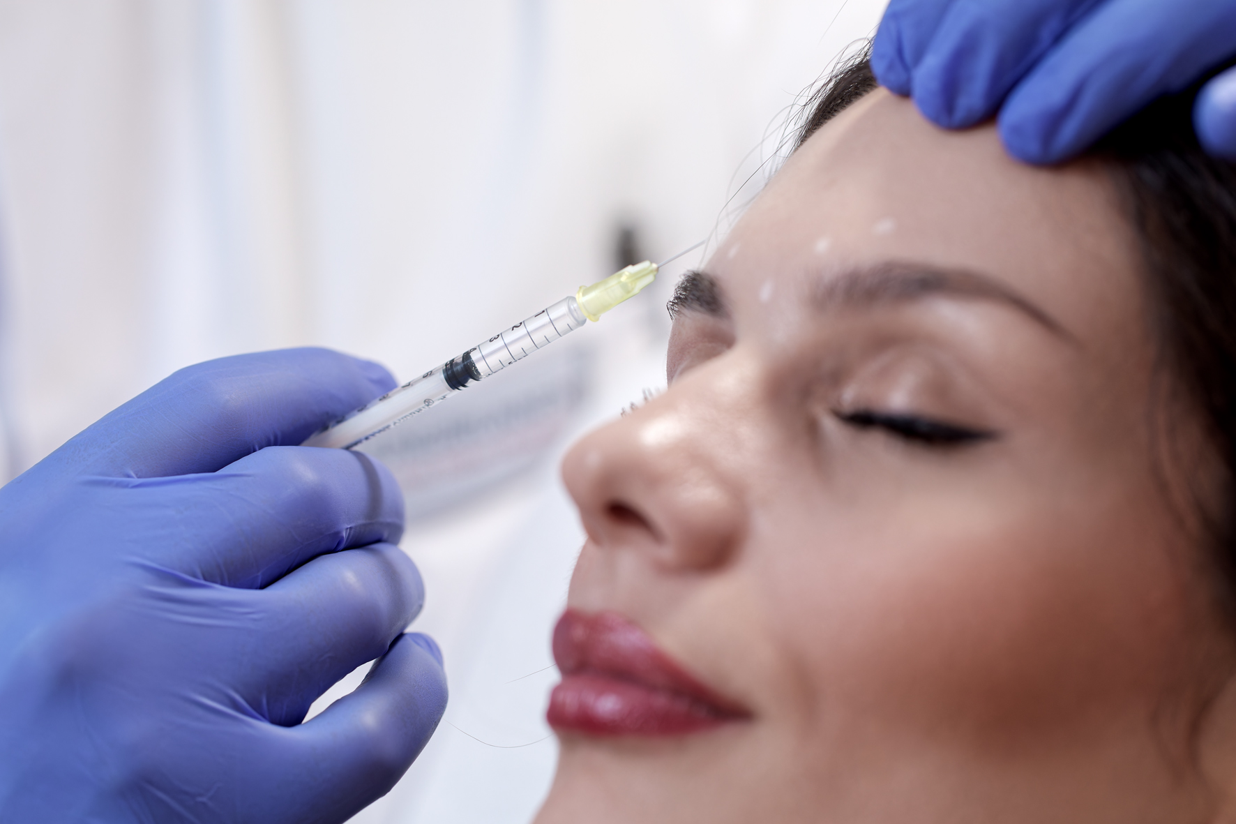 Faltenbehandlung Gesicht